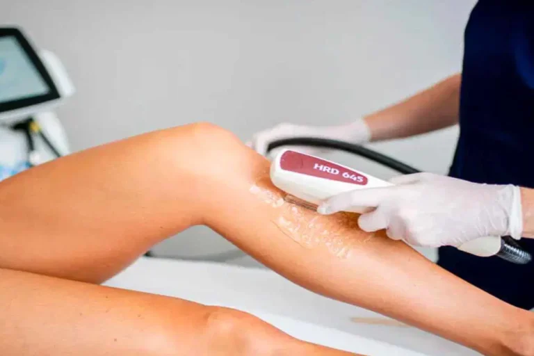 laser-hair-removal-orlando-vitality